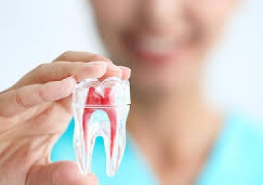 Endodonsista