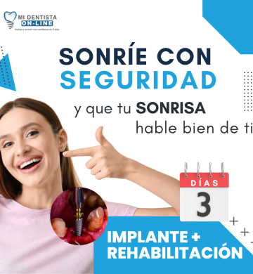 Implantes Dentales CDMX